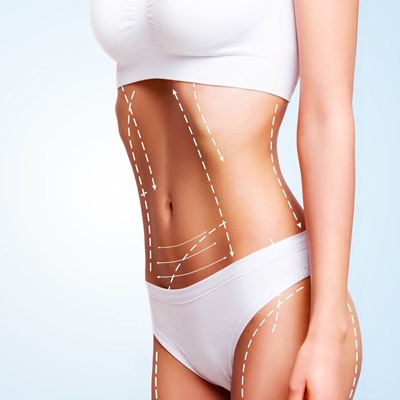 LIPO