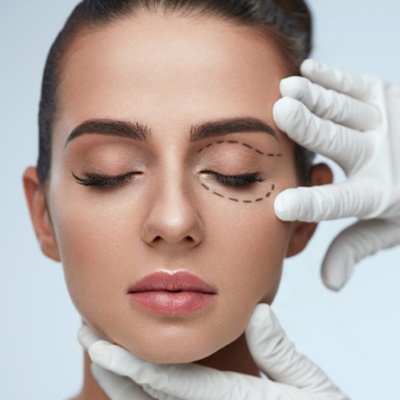 BLEFAROPLASTIA